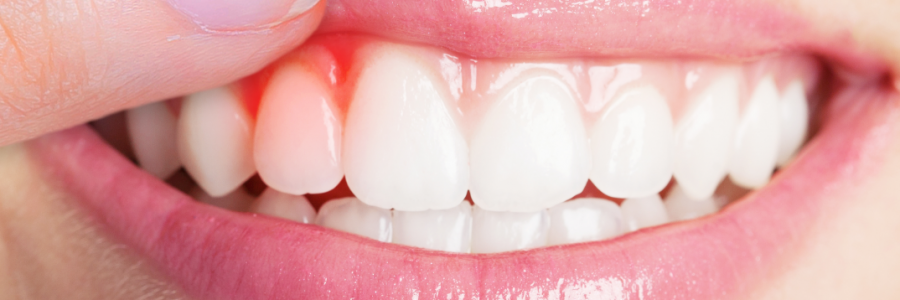 又上火又怕冷？上熱下寒、水火不濟(jì)，教你調(diào)回來！