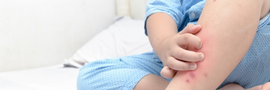 學(xué)古人這樣驅(qū)蚊，從此不再“蚊”風(fēng)喪膽！