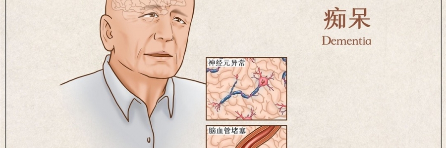 “馬什么梅？”年紀輕輕老忘事，竟是癡呆的前兆？！