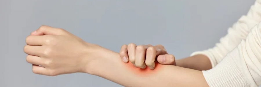 濕疹、瘙癢、蕁麻疹……患皮膚病，也許是好事！