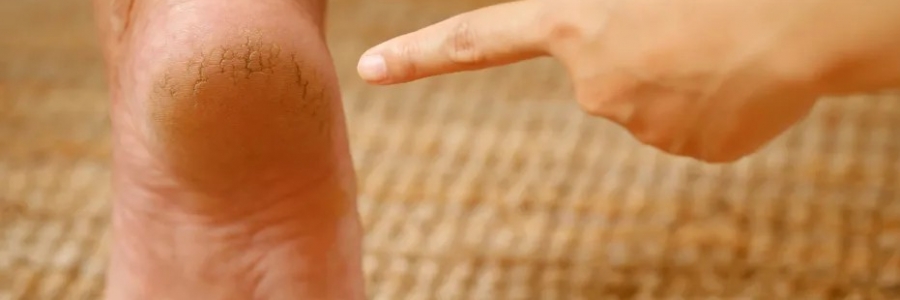 每天跺跺腳，從腳養(yǎng)到頭，越跺越年輕！